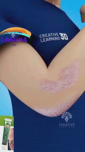 Summifun - Psoriasis Cream (Original)